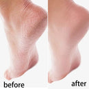 Reusable Silicone Moisturizing Mask Socks & Gloves – Exfoliating, Anti-Crack, and Hydrating Foot and Hand Care Tool