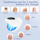 USB Rechargeable Nail Care Device – 940nm Infrared & 500nm Blue Light Therapy