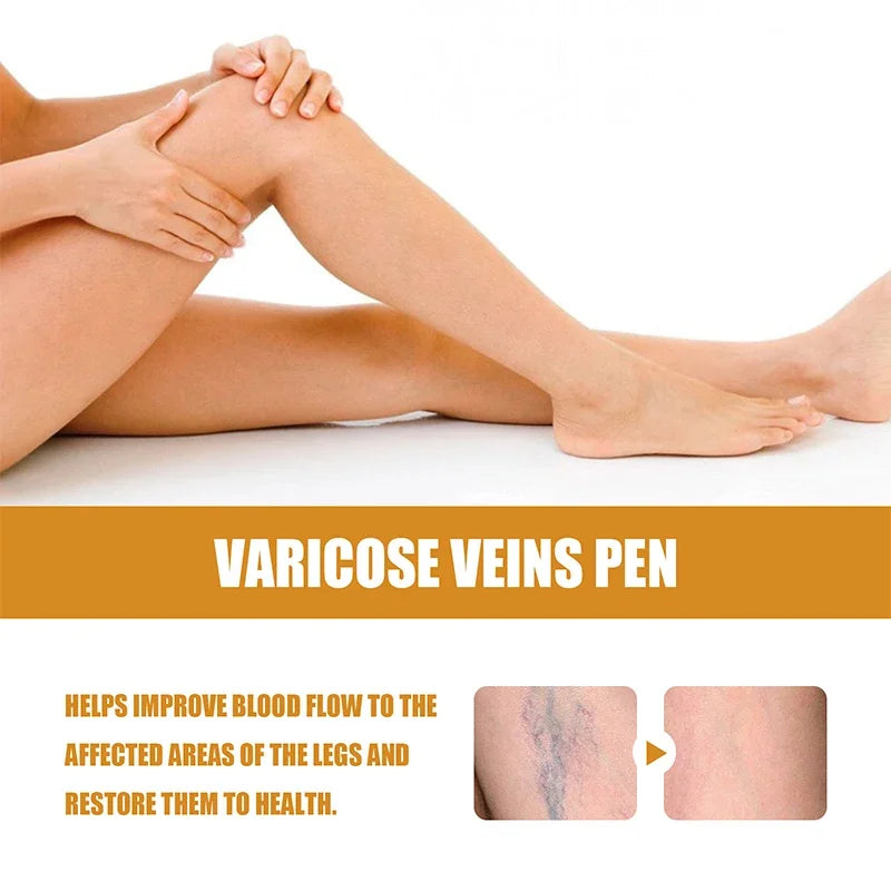 Laser Therapy Pen for Varicose Veins | Blue Light Treatment Device for Pain Relief & Circulation Improvement